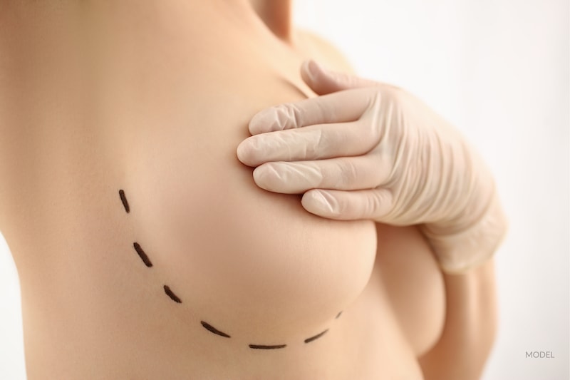 Woman with a gloved hand covering nipple on her bare breast. Close up view.