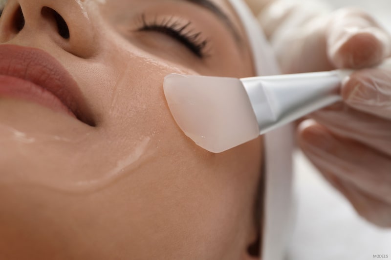 A woman receives a chemical peel.